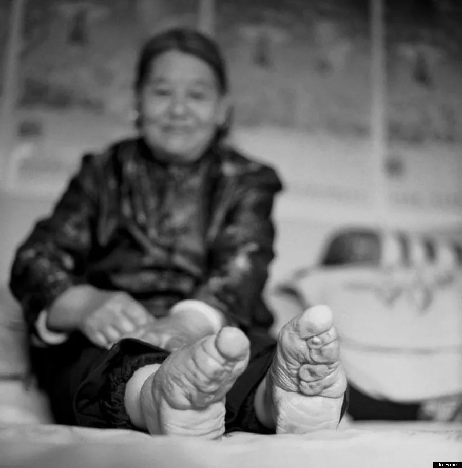 A tradição dos pés de lótus como padrão de beleza feminino era comum em áreas rurais da China até a década de 1940, e foi banida por determinação do governo chinês